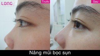 nang-mui-boc-sun-bao-lau-se-cao-va-dep