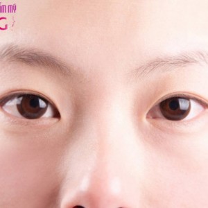 lam-gi-khac-phuc-tinh-trang-mat-2-mi-sup-1