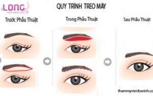 nang-chan-may-gia-bao-nhieu-tien