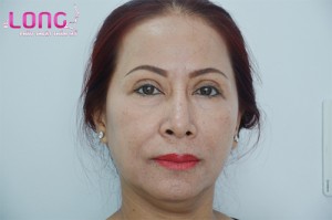 mat-2-mi-khong-deu-co-tao-mat-2-mi-duoc-khong-1