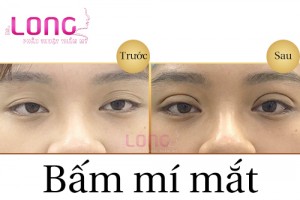 bam-mi-mat-xong-co-bi-sung-bam-khong-1