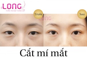 ban-nen-lua-chon-cat-mi-mat-hay-bam-mi-mat-1