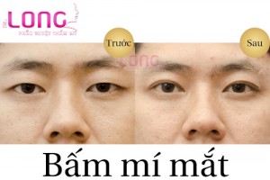 bam-mi-mat-cho-nam-duoc-thuc-hien-nhu-the-nao-1