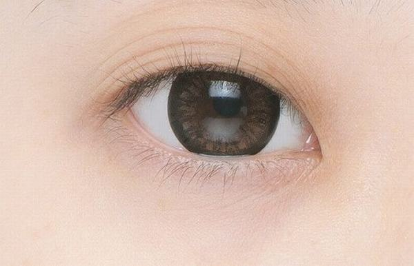 Đôi mắt ba mí có các nếp gấp xếp chồng lên nhau
