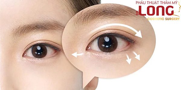 Cắt mí mắt và cách chăm sóc mắt để giữ dáng mí lâu dài 1 cat-mi-mat
