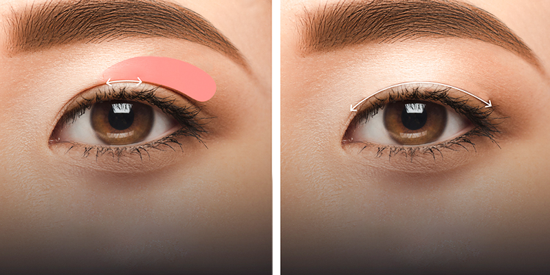 Nhấn mí có được lâu không?