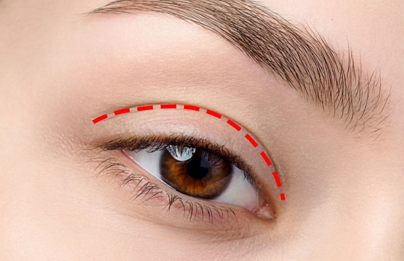 nhấn mí kiêng gì